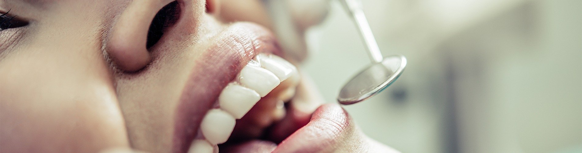 ¿Cómo ha afectado la crisis en la estética dental?