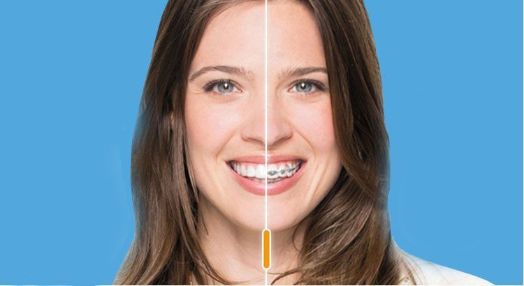 Elegir la ortodoncia