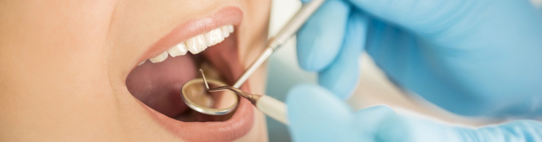 Cómo podemos cuidar el esmalte dental
