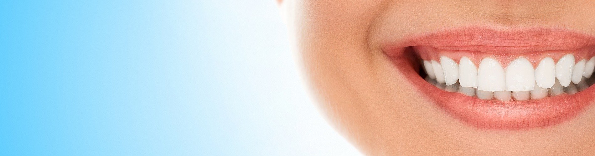 Blancorexia, obsesión por los dientes blancos