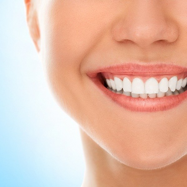 blancorexia dientes blancos