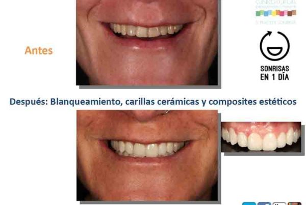 forma de mis dientes