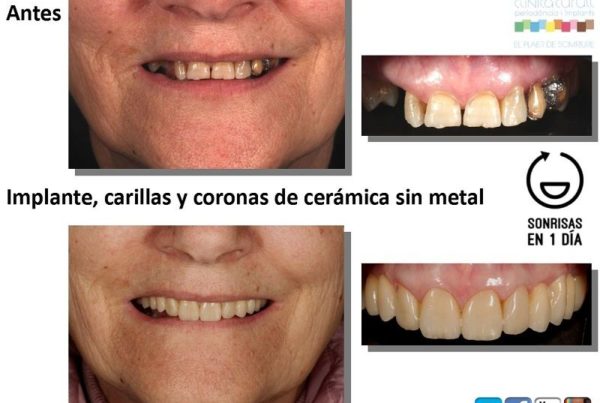 tener boca sana
