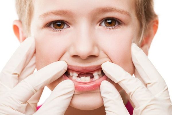 Qué hacer ante un traumatismo dental