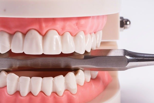 prótesis dentales