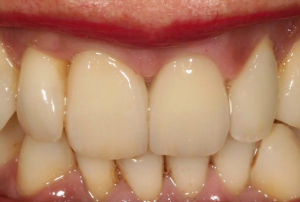 renovar el aspecto de la sonrisa