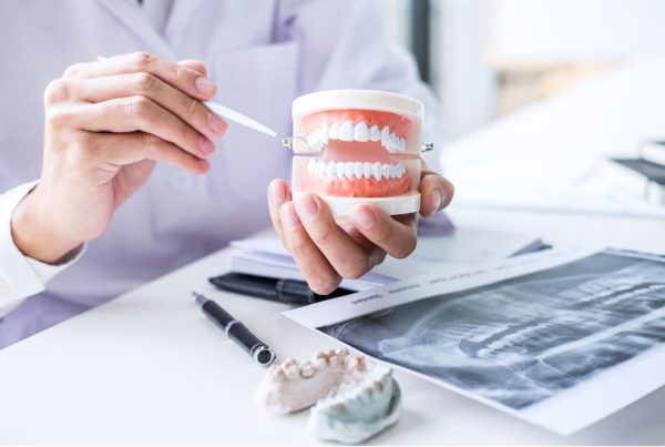 Todo sobre pérdida de hueso dental