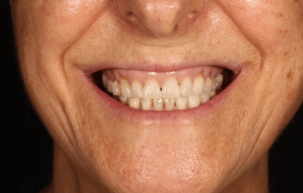 Antes Maria Jesus Infante