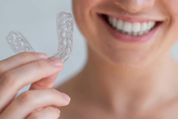 ¿Por qué utilizar retenedores dentales después de la ortodoncia?