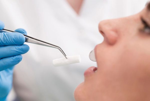 ¿Qué es la gingivitis descamativa y cómo tratarla?
