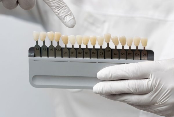 Fractura coronaria: tratamiento con coronas dentales