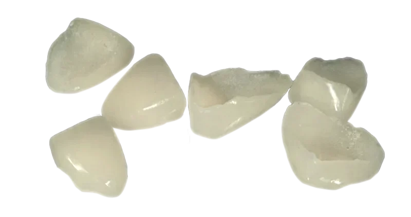 carillas-cerámica