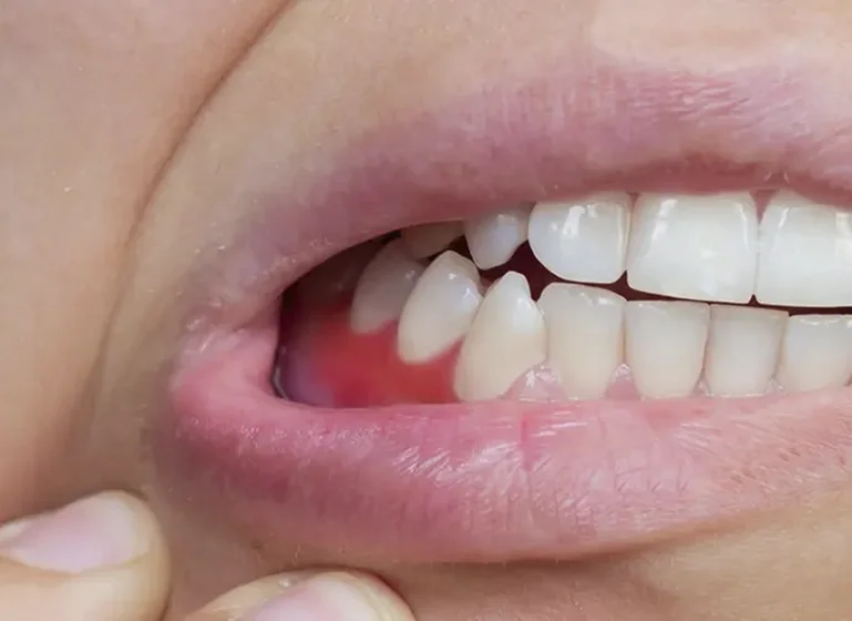 Dentista Especialista en Encías