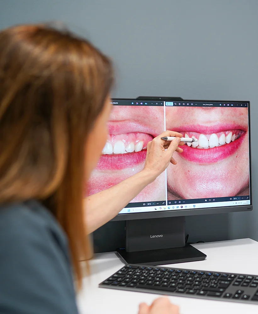 Periodoncia Tarragona