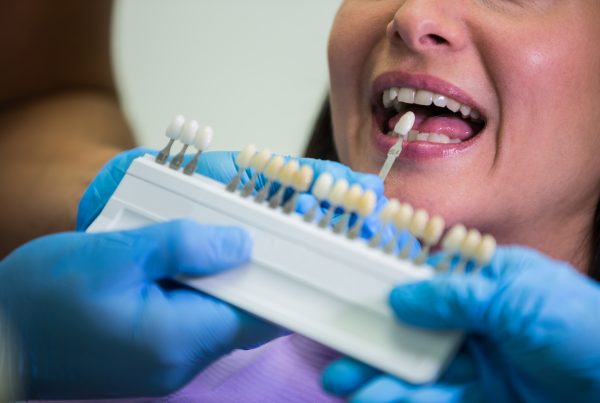 que son los implantes dentales