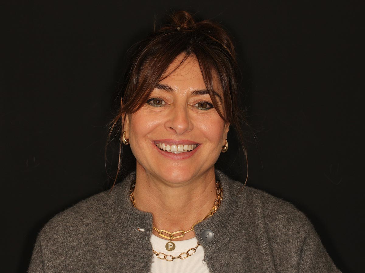 Antes del tratamiento de carillas dentales en Clínica Curull Tarragona — caso real de Paula Elena Ruiz
